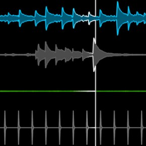 mzl.frwowyze.320x480-75